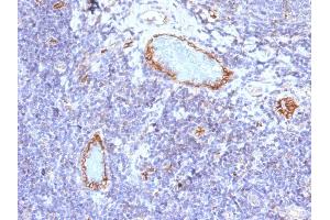 Formalin-fixed, paraffin-embedded human Tonsil stained with vWF Mouse Monoclonal Antibody (VWF/1465). (VWF anticorps  (AA 1815-1939))