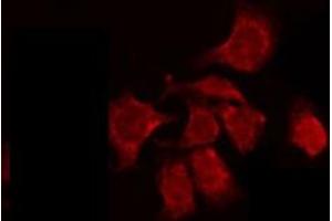 ABIN6274901 staining HepG2 by IF/ICC. (BCL2L12 anticorps  (Internal Region))