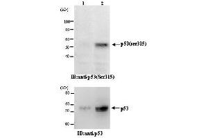 Western Blotting (WB) image for anti-Tumor Protein P53 (TP53) (pSer315) antibody (ABIN1449252) (p53 anticorps  (pSer315))