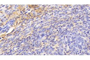 Detection of PIIINP in Mouse Uterus Tissue using Polyclonal Antibody to Procollagen III N-Terminal Propeptide (PIIINP)