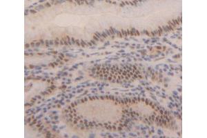 Used in DAB staining on fromalin fixed paraffin- embedded Kidney tissue (MBD2 anticorps  (AA 145-411))