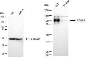 Western blotting analysis using ATG9A antibody (ABIN7797677).
