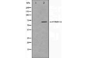 Western blot analysis on COS7 cell lysate using NYREN18 Antibody,The lane on the left is treated with the antigen-specific peptide. (NUB1 anticorps)
