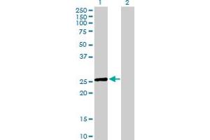 Western Blot analysis of EGLN3 expression in transfected 293T cell line by EGLN3 MaxPab polyclonal antibody. (EGLN3 anticorps  (AA 1-239))