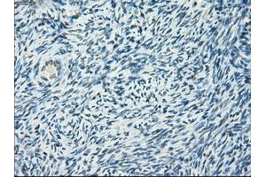 Immunohistochemical staining of paraffin-embedded colon tissue using anti-PORmouse monoclonal antibody. (POR anticorps)