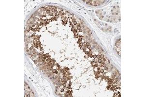Immunohistochemical staining (Formalin-fixed paraffin-embedded sections) of human testis with CRAT polyclonal antibody  shows strong cytoplasmic positivity in cells in seminiferous ducts. (CRAT anticorps)