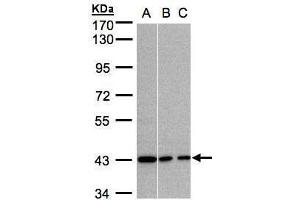 WB Image Sample (30μg whole cell lysate) A:A431, B:MOLT4 , C:Raji , 7. (G Protein alpha Inhibitor 3 (Center) anticorps)