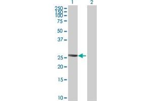 Western Blot analysis of PTTG2 expression in transfected 293T cell line ( H00010744-T01 ) by PTTG2 MaxPab polyclonal antibody. (PTTG2 anticorps  (AA 1-191))