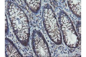 Image no. 4 for anti-Prefoldin Subunit 3 (PFDN3) antibody (ABIN1501706)