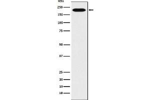 Western blot analysis of RhoGAP expression in Hela cell lysate.