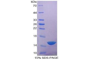 SDS-PAGE analysis of Human Acid Phosphatase 1 Protein. (ACP1 Protéine)