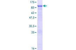 Image no. 1 for Fermitin Family Member 1 (FERMT1) (AA 1-677) protein (GST tag) (ABIN1353959)