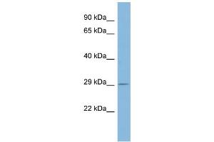 WB Suggested Anti-PSMD10 Antibody Titration: 0. (PSMD10 anticorps  (Middle Region))