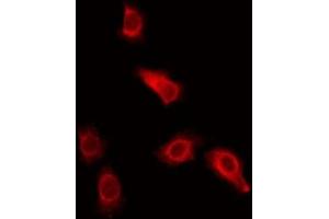 ABIN6275649 staining Hela by IF/ICC. (Ubiquilin 3 anticorps  (Internal Region))
