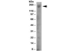Western blot testing of human A431 lysate with DOCK1 antibody at 4ug/ml. (DOCK1 anticorps)