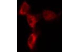 ABIN6274621 staining 293T by IF/ICC. (COL1A2 anticorps  (N-Term))