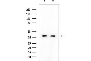 anti-Aflatoxin Beta1 Aldehyde Reductase (AKR7A2) (Internal Region) antibody