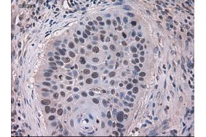 Immunohistochemical staining of paraffin-embedded kidney using anti-KRT18 (ABIN2452674) mouse monoclonal antibody. (Cytokeratin 18 anticorps  (AA 69-372))
