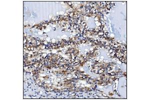 IHC analysis of KCNQ2 using anti-KCNQ2 antibody (ABIN7601522).
