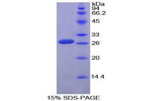 SDS-PAGE (SDS) image for SP100 Nuclear Antigen (SP100) (AA 261-465) protein (His tag) (ABIN1879647)