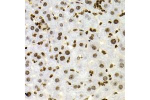 Immunohistochemistry of paraffin-embedded mouse liver using NFKB2 Antibody.