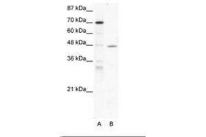 Image no. 1 for anti-Nuclear Receptor Subfamily 2, Group F, Member 6 (NR2F6) (AA 264-313) antibody (ABIN202436)