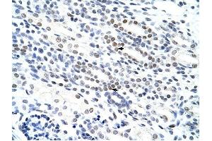 NOL4 antibody was used for immunohistochemistry at a concentration of 4-8 ug/ml to stain Epithelial cells of renal tubule (arrows) in Human Kidney. (NOL4 anticorps  (N-Term))