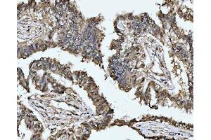IHC analysis of MAT2A using anti-MAT2A antibody (ABIN7599120). (MAT2A anticorps  (AA 1-229))