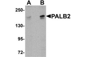Western Blotting (WB) image for anti-Partner and Localizer of BRCA2 (PALB2) (C-Term) antibody (ABIN1030568) (PALB2 anticorps  (C-Term))