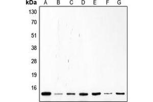 Western blot analysis of p14 ARF expression in Saos2 (A), Molt (B), K562 (C), Jurkat (D), HL60 (E), MCF7 (F), HeLa (G) whole cell lysates. (CDKN2A anticorps  (Center))