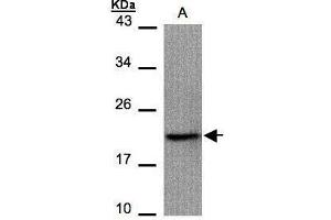 WB Image Sample(30 μg of whole cell lysate) A:293T 15% SDS PAGE antibody diluted at 1:1000 (Survivin anticorps)