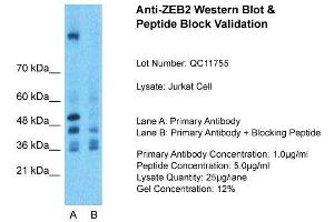 Host:  Rabbit  Target Name:  ZEB2  Sample Type:  Jurkat Whole Cell  Lane A:  Primary Antibody  Lane B:  Primary Antibody + Blocking Peptide  Primary Antibody Concentration:  1ug/ml  Peptide Concentration:  5ug/ml  Lysate Quantity:  25ug/lane/Lane  Gel Concentration:  0. (ZEB2 anticorps  (N-Term))