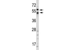 Western blot analysis of CA9 antibody and HepG2 lysate. (CA9 anticorps  (AA 63-90))