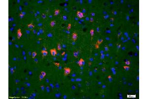 Formalin-fixed and paraffin-embedded rat brain labeled with Anti-TRAK1 Polyclonal Antibody, Unconjugated (ABIN711011) 1:200, overnight at 4°C, The secondary antibody was Goat Anti-Rabbit IgG, Cy3 conjugated used at 1:200 dilution for 40 minutes at 37°C.