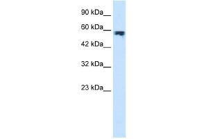 WB Suggested Anti-ZYX Antibody Titration:  1. (ZYX anticorps  (Middle Region))