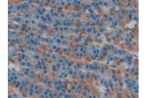 DAB staining on IHC-P; Samples: Rat Intestine Tissue (P-Selectin anticorps  (AA 58-158))