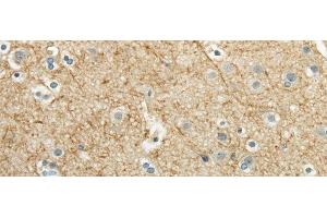 Immunohistochemistry of paraffin-embedded Human brain using WNT2 Polyclonal Antibody at dilution of 1/40