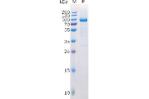 Human Protein, hFc Tag on SDS-PAGE under reducing condition.