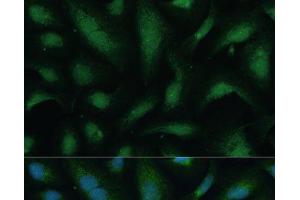Immunofluorescence analysis of U-2 OS cells using KIF14 Polyclonal Antibody at dilution of 1:100 (40x lens).