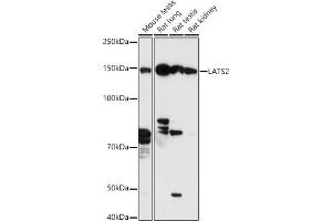 Western blot analysis of extracts of various cell lines, using L antibody (ABIN7268192) at 1:500 dilution. (LATS2 anticorps  (AA 1-100))