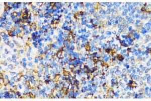 Immunohistochemistry of paraffin-embedded Mouse spleen using PBEF / NAMPT Polyclonal Antibody at dilution of 1:100 (40x lens). (NAMPT anticorps)