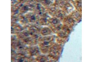 #VALUE! (LECT1 anticorps  (AA 134-334))