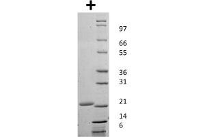 SDS-PAGE of Mouse Granulocyte Colony Stimulating Factor Recombinant Protein SDS-PAGE of Mouse Granulocyte Colony Stimulating Factor Recombinant Protein. (G-CSF Protéine)
