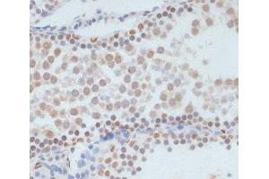 Immunohistochemistry of paraffin-embedded Rat testis using Phospho-p53(S33) Polyclonal Antibody at dilution of 1:100 (40x lens).