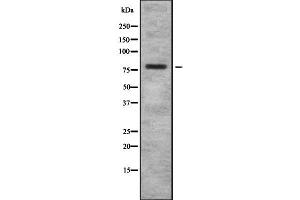 Western blot analysis of BCAM using COLO205 whole cell lysates (BCAM anticorps  (C-Term))