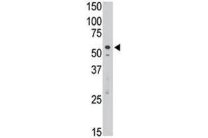 SIGLEC7 antibody used in western blot to detect Dsiglec/SIGLEC7 in Jurkat cell lysate (SIGLEC7 anticorps  (AA 407-438))