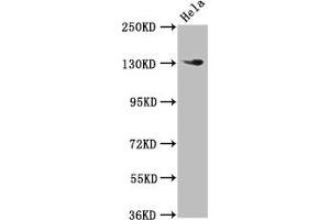 Western Blot Positive WB detected in: Hela whole cell lysate All lanes: NOMO1 antibody at 3 μg/mL Secondary Goat polyclonal to rabbit IgG at 1/50000 dilution Predicted band size: 135 kDa Observed band size: 135 kDa (NOMO1 anticorps  (AA 918-1044))