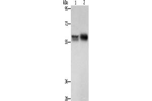 Western blot analysis of Hepg2 cells NIH/3T3 cells using ZBTB7A Polyclonal Antibody at dilution of 1:500 (ZBTB7A anticorps)