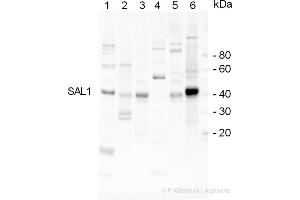 Western Blotting (WB) image for anti-Inositol Polyphosphate-1-Phosphatase (INPP1) antibody (ABIN334556) (INPP1 anticorps)