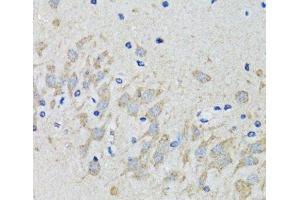 Immunohistochemistry of paraffin-embedded Mouse brain using HTR2B Polyclonal Antibody at dilution of 1:100 (40x lens). (Serotonin Receptor 2B anticorps)